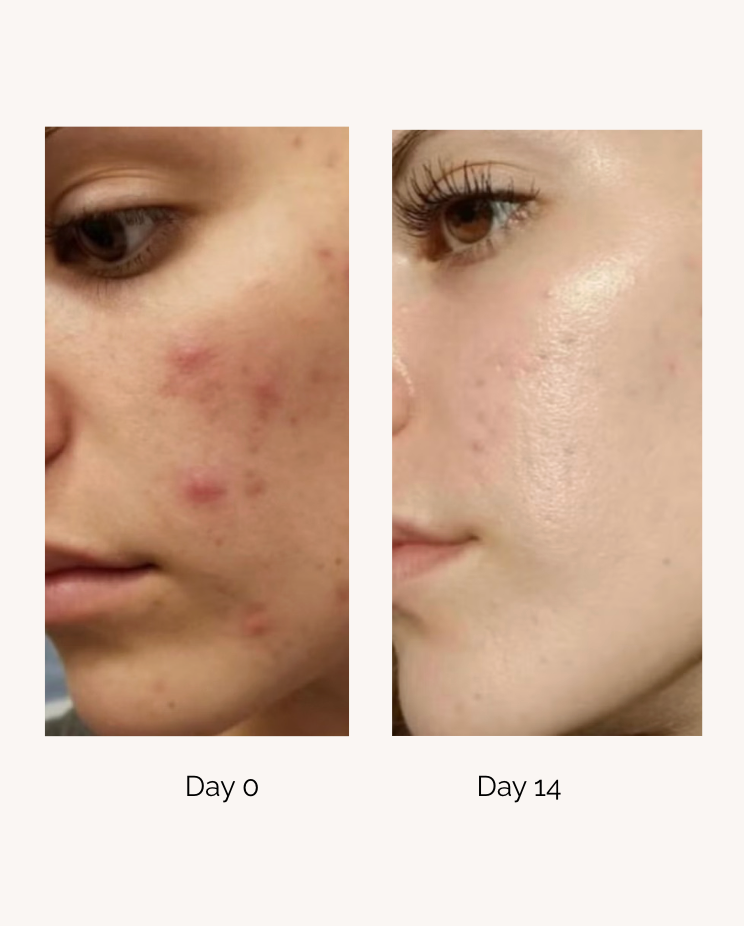 PURE AURA Blemish Corrector 20ml